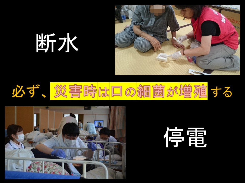 画像資料(災害時は口の菌が増殖する)